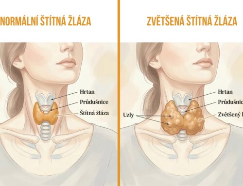 Zvětšená štítná žláza: Jak ji poznat a proč ji nepodceňovat?